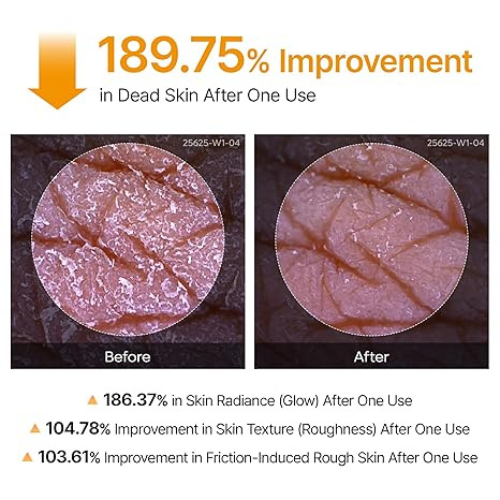 Luna Skin Koljic Acid Peel Shot