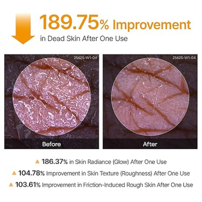 Luna Skin Koljic Acid Peel Shot